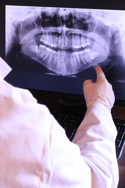 Best Emergency Dentist for Lost Fillings or Crowns in Bloomfield, NY